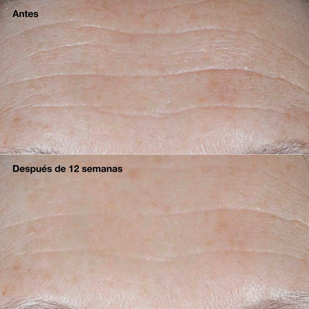 SMART CLINICAL REPAIR WRINKLE CORRECTING CREAM (CREMA HIDRATANTE ANTI EDAD CON PROTECTOR SOLAR)